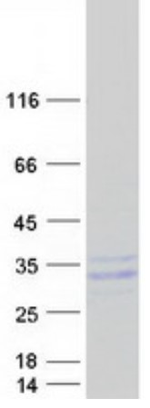 SDS-PAGE (PAEP-6549H).jpg